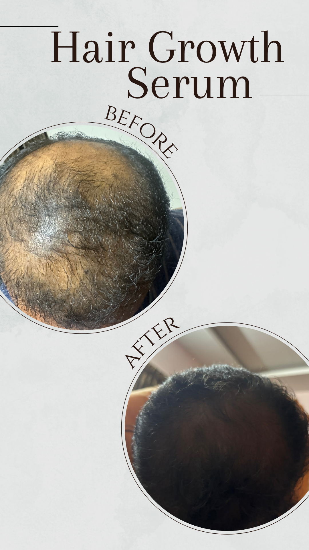 Hair Growth Serum Before and After results