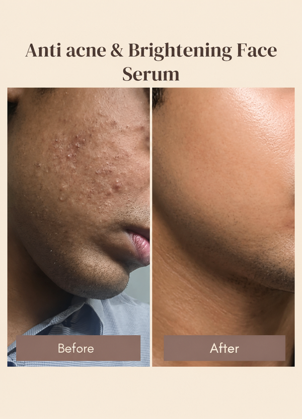 Before and after visual comparison of faded post-blemish dark spots and even skin tone