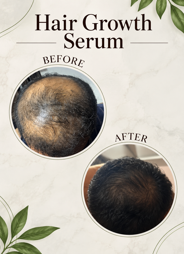 Before and after comparison showing smoother skin texture with 6M Veyra routine