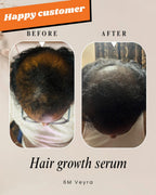 Hair Growth Serum