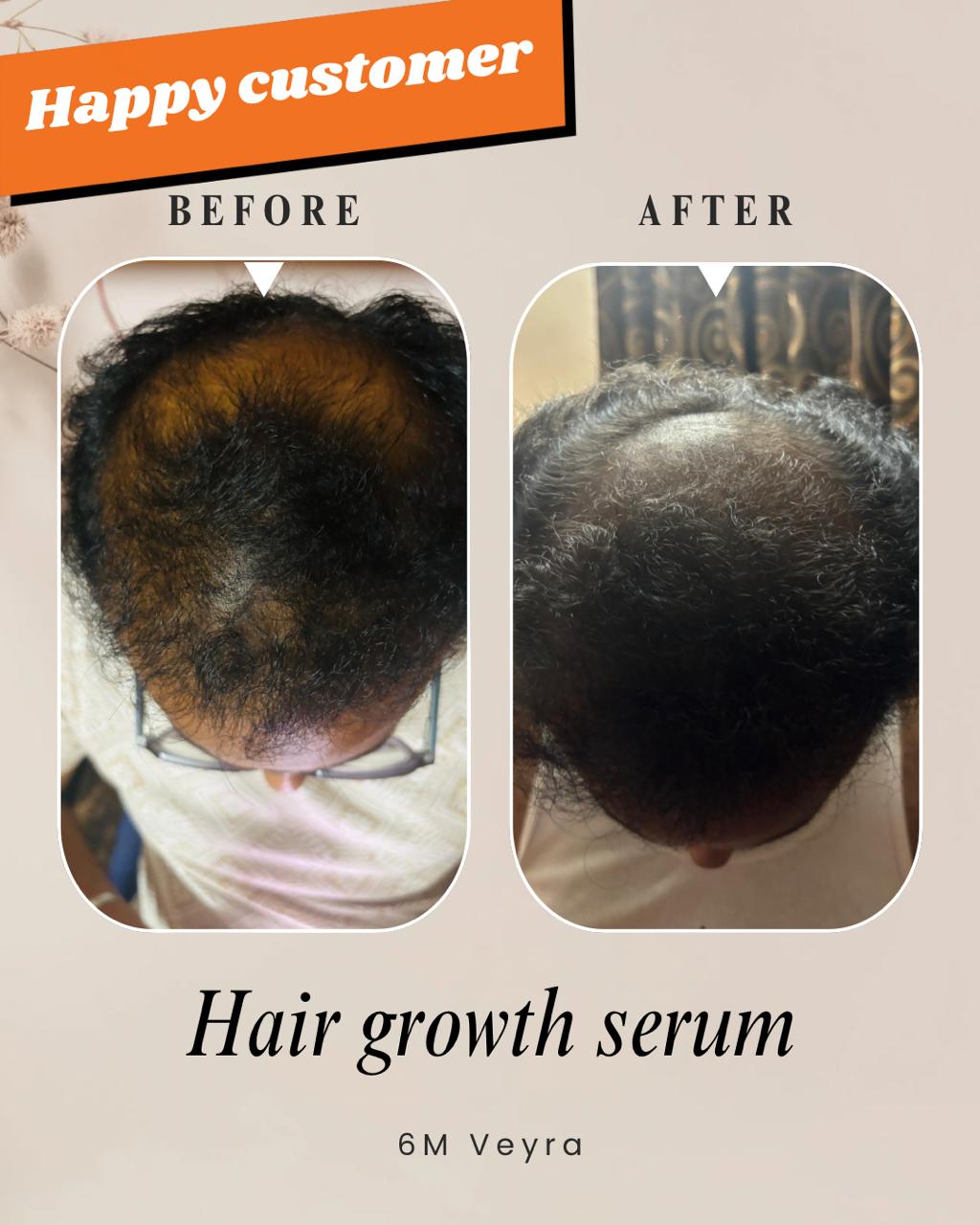 Hair Growth Serum