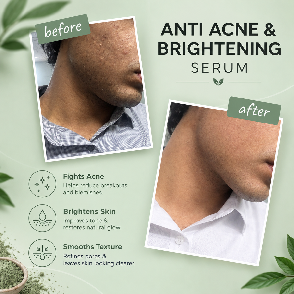 Application image for Clarifying Serum For Acne-Prone & Uneven Skin by 6M Veyra