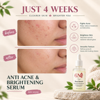 Ingredient highlights for Clarifying Serum For Acne-Prone & Uneven Skin by 6M Veyra