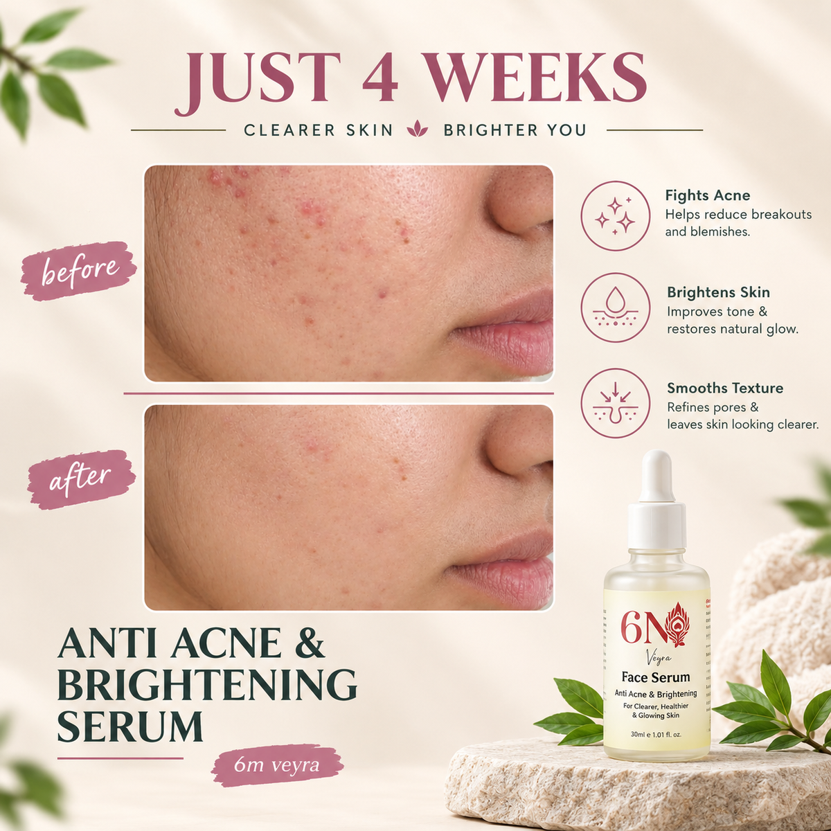 Ingredient highlights for Clarifying Serum For Acne-Prone & Uneven Skin by 6M Veyra