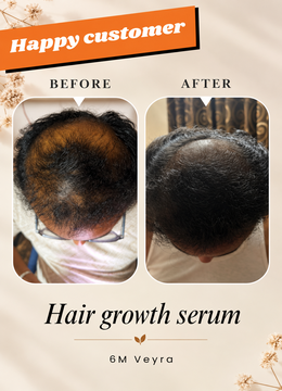 Product detail image for Hair Growth Serum by 6M Veyra